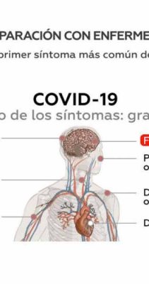 Como se diferencia el Covid19, la gripe, el resfrío común y la alergia.